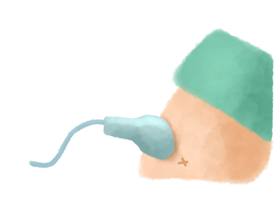 超音波検査(エコー検査)